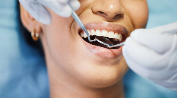 Best Emergency Dental Care for Broken or Chipped Teeth in Fairview, NY
