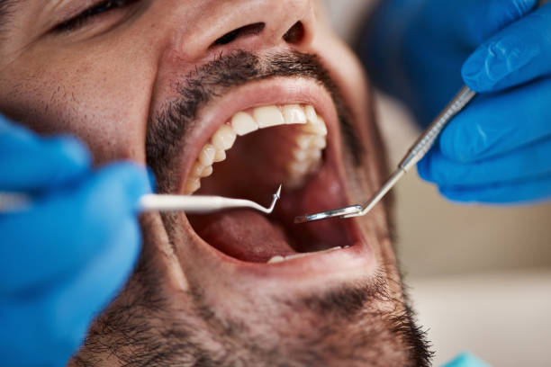 Best Emergency Treatment for Dental Infections or Abscesses in Fairview, NY