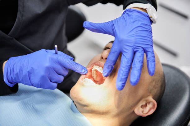 Best Emergency Treatment for Dental Infections or Abscesses in Fairview, NY